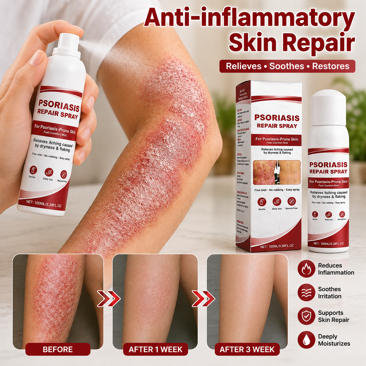 KUBOZN® Beef Tallow Spray for Itchy, Flaky Psoriasis Skin